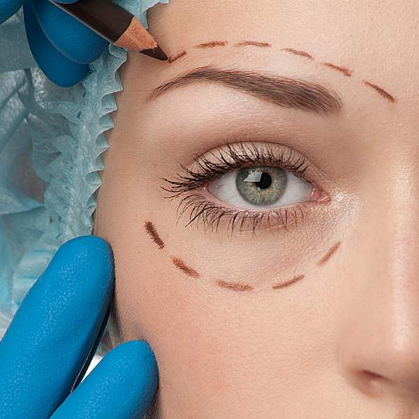 Cirugía estética ocular